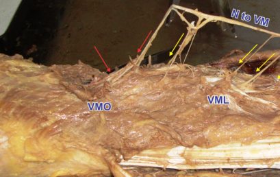 Muscoli nei muscoli: analisi del vasto mediale lungo e del vasto mediale obliquo