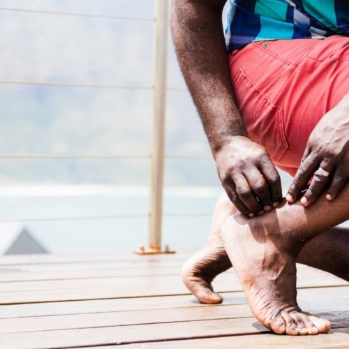 Controllo neuromuscolare dei glutei nei runner con tendinopatia Achillea