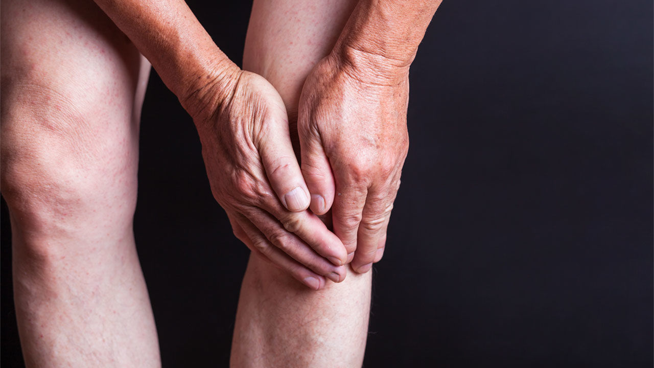 La gravità dell’artrosi non è associata al miglioramento del dolore dopo il trattamento conservativo