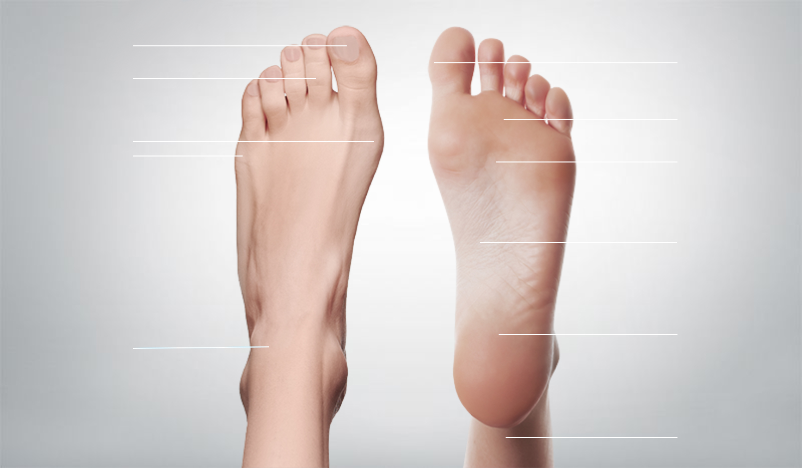 Effetto dell’iperpronazione del piede sulla lordosi lombare e sulla cifosi toracica