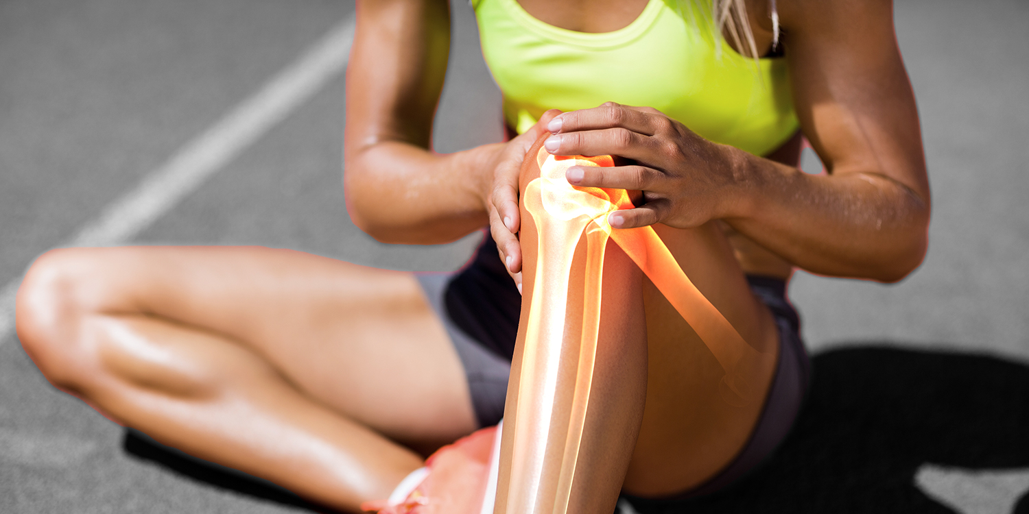 La forza dei muscoli posterolaterali di anca è un fattore di rischio per il dolore femororotuleo?