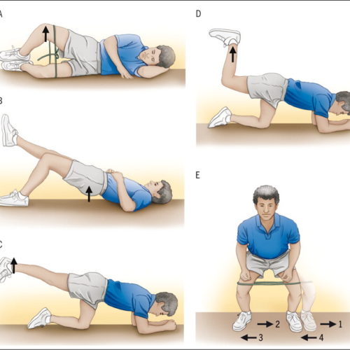 Quali esercizi scegliere per i glutei minimizzando l’attivazione del tensore della fascia lata?