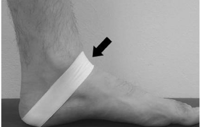 Effetti immediati del tape di stabilizzazione astragalica sulla cinematica della caviglia