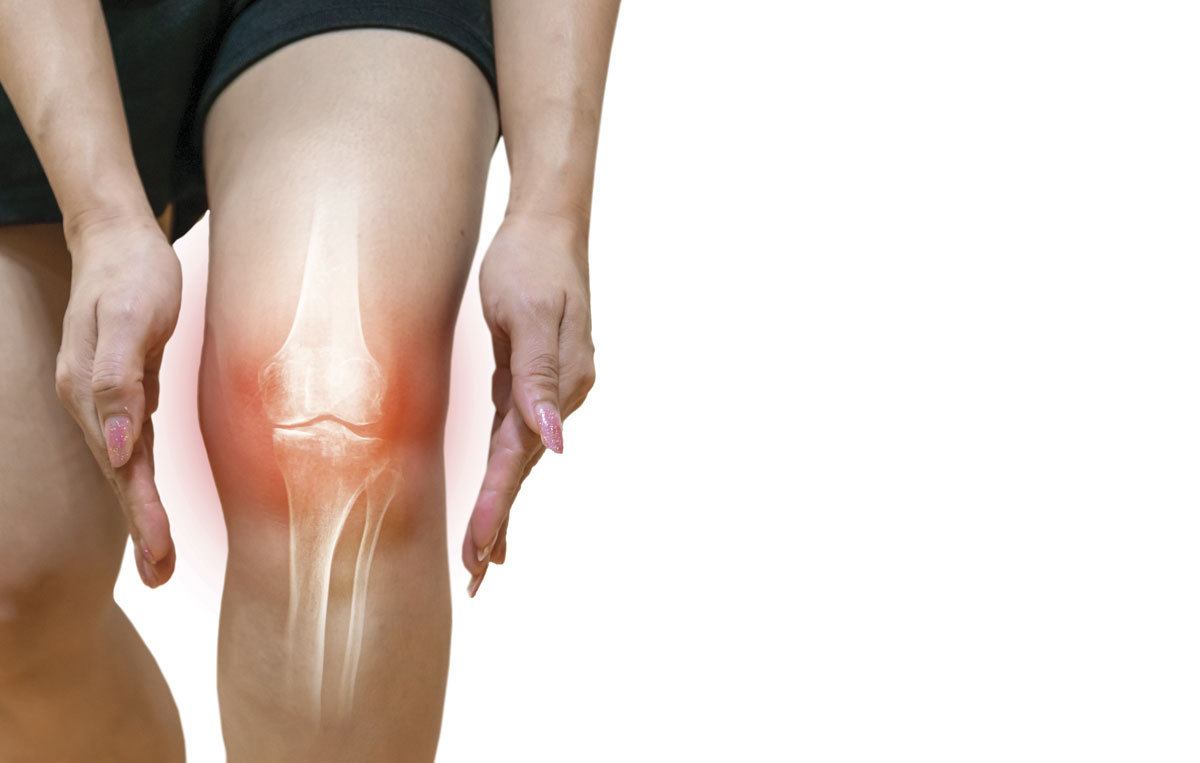 Dolore e funzionalità nell’artrosi di ginocchio